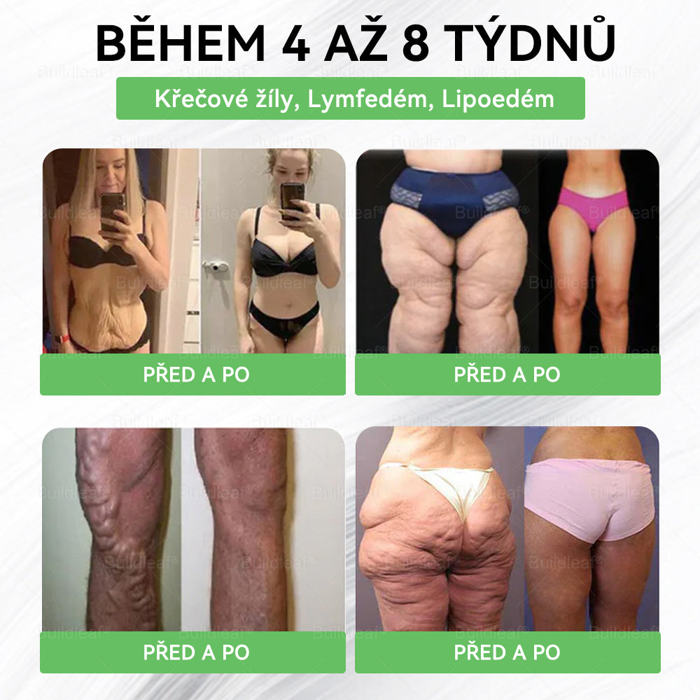 🎁Oficiální obchod ČR | BuildLeaf® GLP-1 8-v-1 Fit & Vital Řešení (Jednou denně, viditelné změny za 7 dní) ✅ Obezita, kardiovaskulární zdraví, cukrovka, spánková apnoe, zdraví střev, problémy se klouby a další