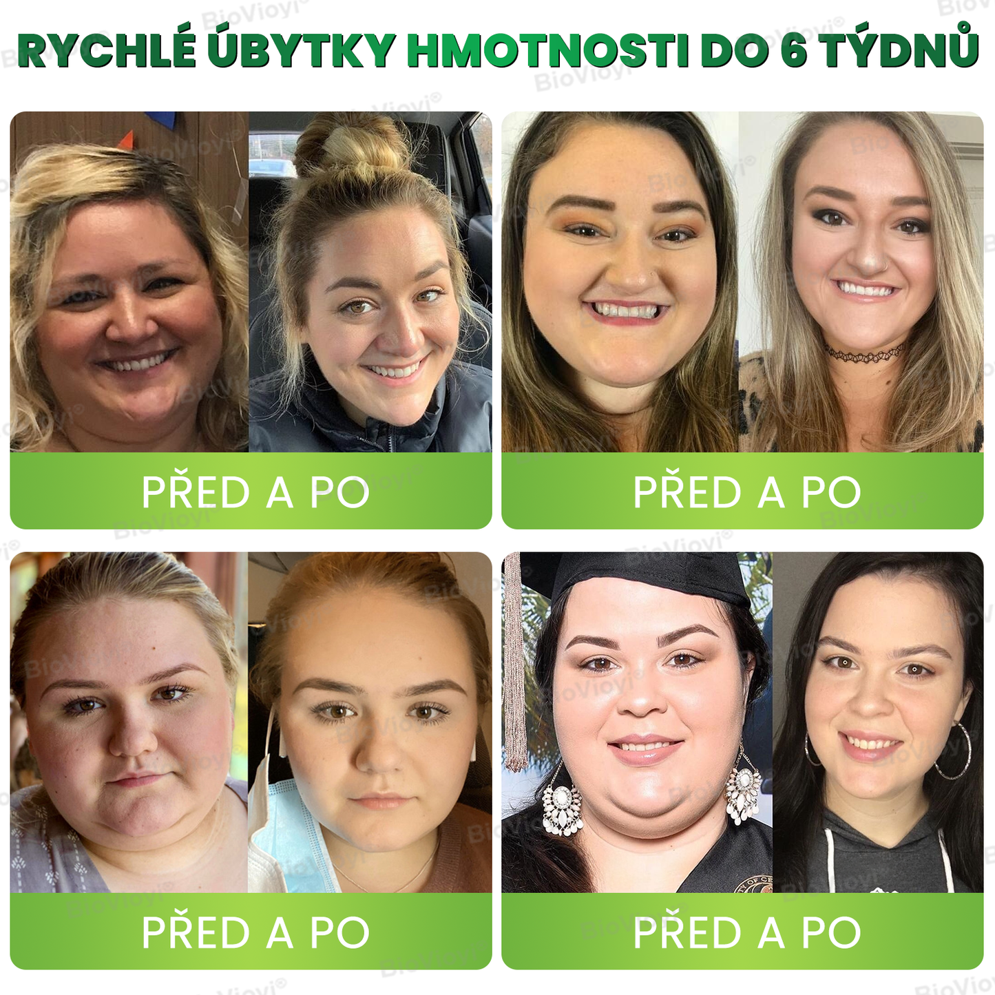 Doporučeno Klinikou Mayo | Oficiální obchod | BioVioyi® GLP-1 Metabolický Boost – kapky na hubnutí a zdraví 🔥 (Spalovač tuků v potravinářské kvalitě – vyvinutý Obesity Society)