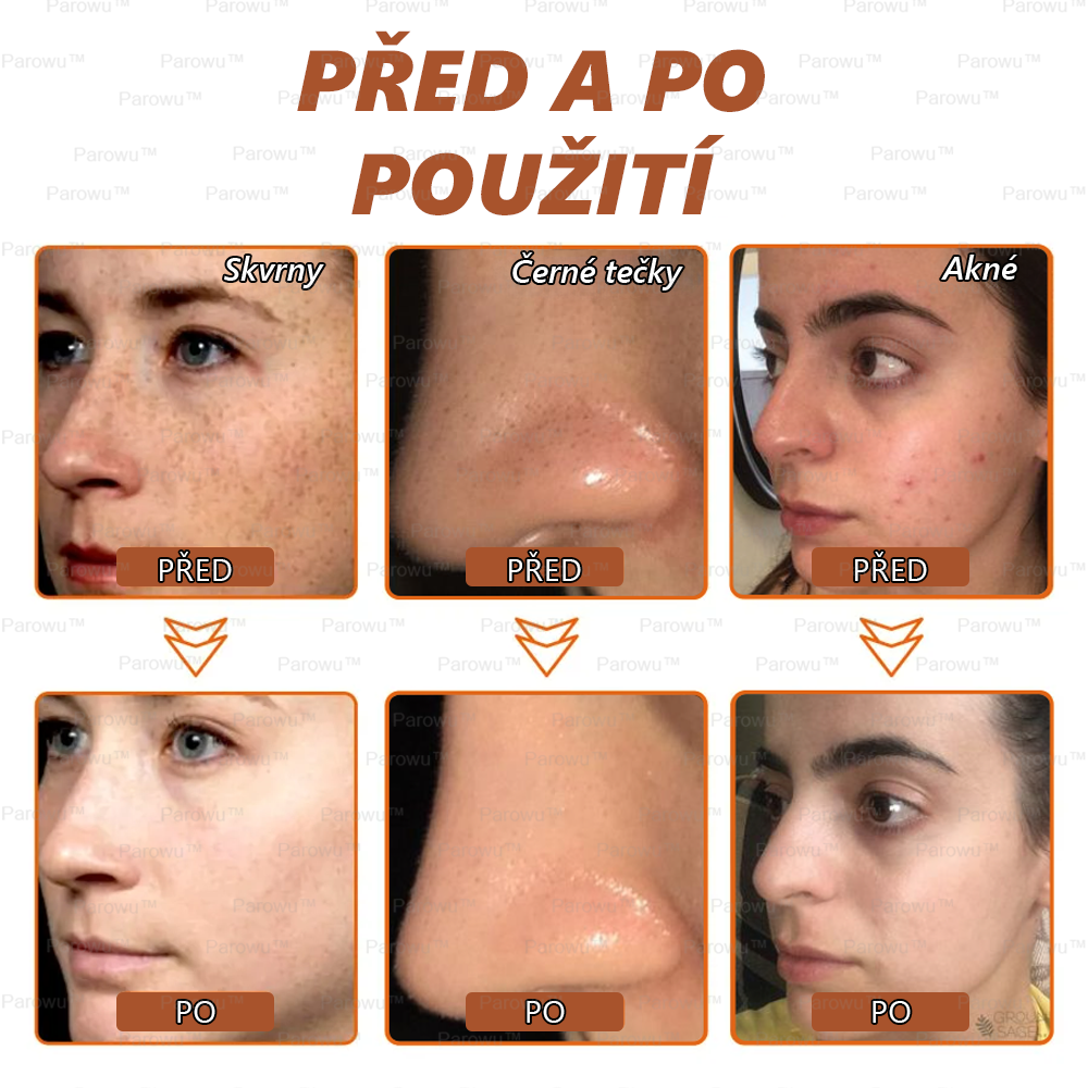 🎁 Gratulujeme! Patříte mezi prvních 200 objednávek! Využijte nyní dodatečnou slevu 50 %! Začněte pečovat o zdraví své pokožky hned teď. Pokud tuto šanci propásnete, příští rok už být nemusí! 🎁 Pospěšte si!