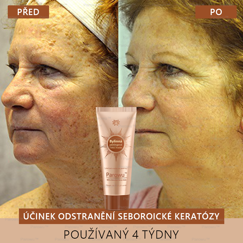 🎁 Gratulujeme! Patříte mezi prvních 200 objednávek! Využijte nyní dodatečnou slevu 50 %! Začněte pečovat o zdraví své pokožky hned teď. Pokud tuto šanci propásnete, příští rok už být nemusí! 🎁 Pospěšte si!