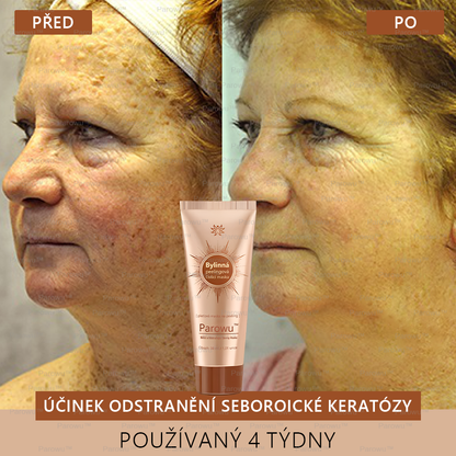 🎁 Gratulujeme! Patříte mezi prvních 200 objednávek! Využijte nyní dodatečnou slevu 50 %! Začněte pečovat o zdraví své pokožky hned teď. Pokud tuto šanci propásnete, příští rok už být nemusí! 🎁 Pospěšte si!