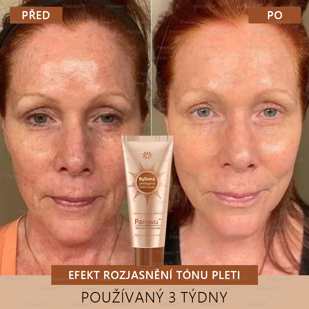 🎁 Gratulujeme! Patříte mezi prvních 200 objednávek! Využijte nyní dodatečnou slevu 50 %! Začněte pečovat o zdraví své pokožky hned teď. Pokud tuto šanci propásnete, příští rok už být nemusí! 🎁 Pospěšte si!
