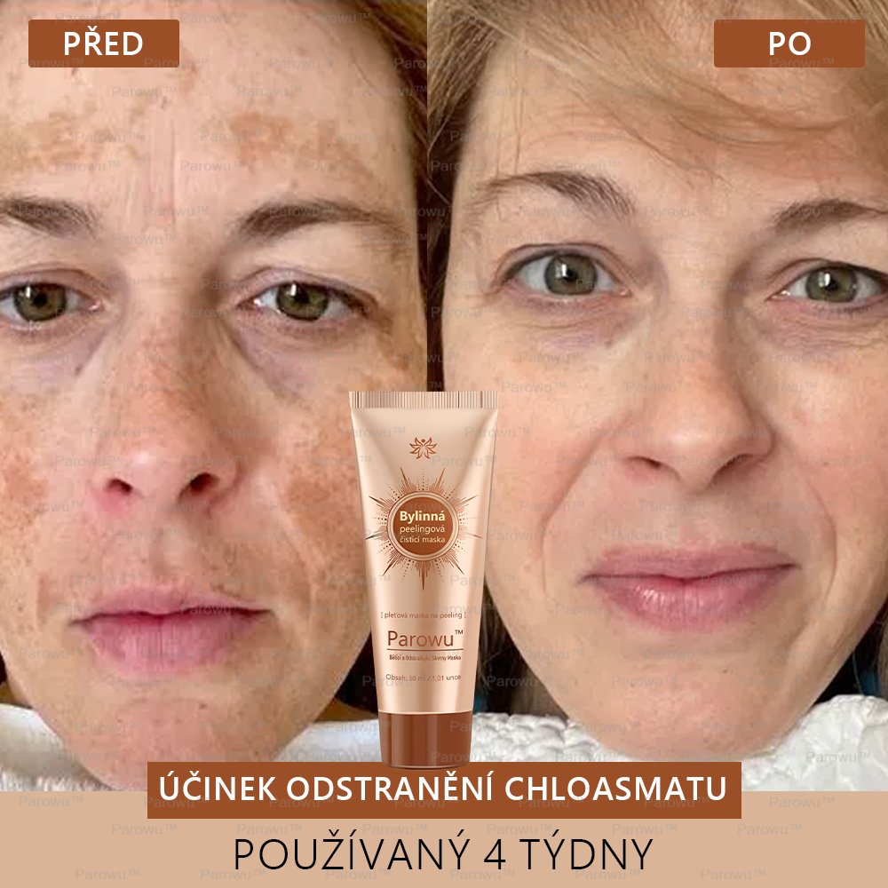 🎁 Gratulujeme! Patříte mezi prvních 200 objednávek! Využijte nyní dodatečnou slevu 50 %! Začněte pečovat o zdraví své pokožky hned teď. Pokud tuto šanci propásnete, příští rok už být nemusí! 🎁 Pospěšte si!
